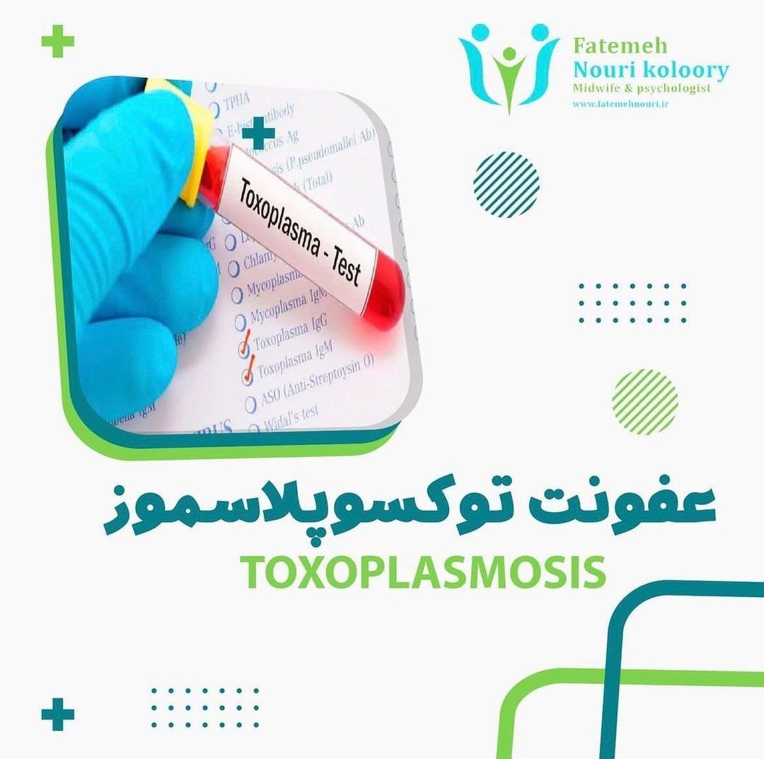 عفونت تکسوپلاسموز